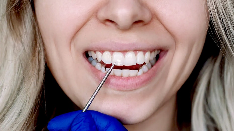 researchers-say-human-hair-could-soon-be-key-to-repairing-teeth-damaged-by-cavities