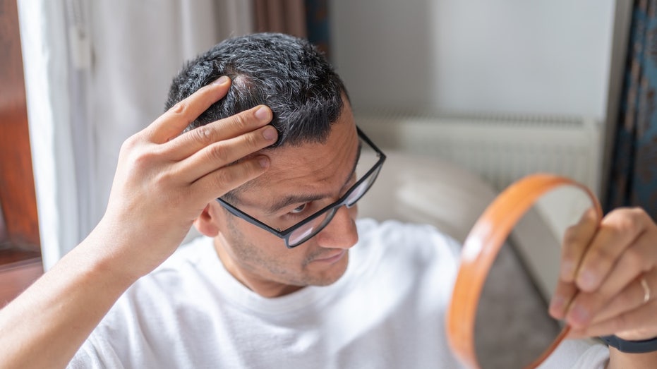 new-baldness-treatment-shows-dramatic-hair-regrowth-gains-in-major-trial