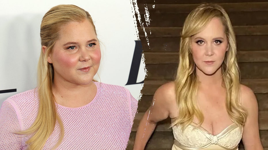 what-to-know-about-cushing’s-syndrome,-which-led-to-amy-schumer’s-dramatic-weight-loss