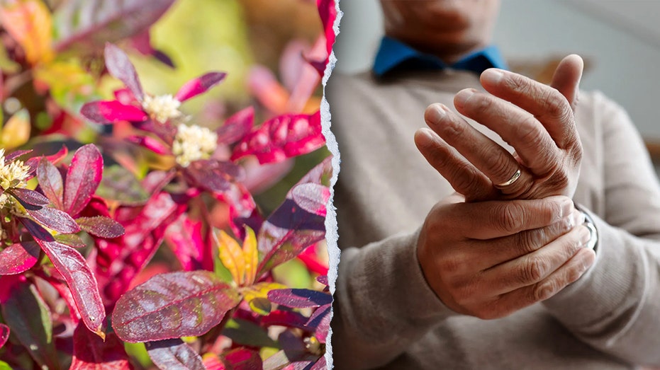 traditional-brazilian-plant-shows-unexpected-strength-against-arthritis