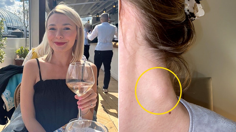 woman’s-painful-reaction-to-wine-leads-to-life-changing-cancer-discovery