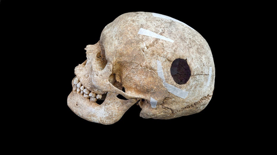 archaeologists-uncover-evidence-of-early-brain-surgery-on-9th-century-man