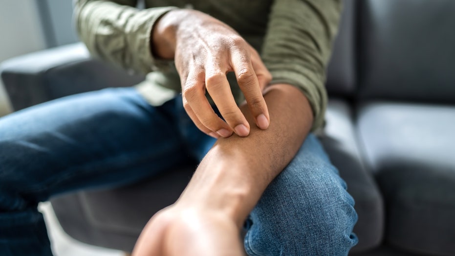 state-confirms-outbreak-of-sexually-transmitted-fungal-infection,-experts-urge-caution